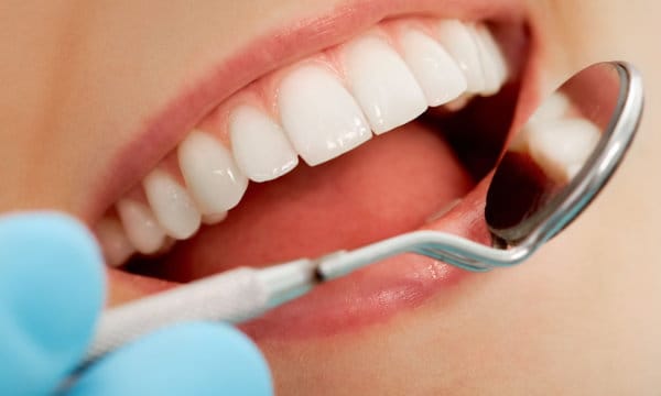 Dental bonding service