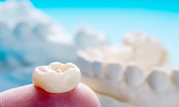 Crowns and fillings service