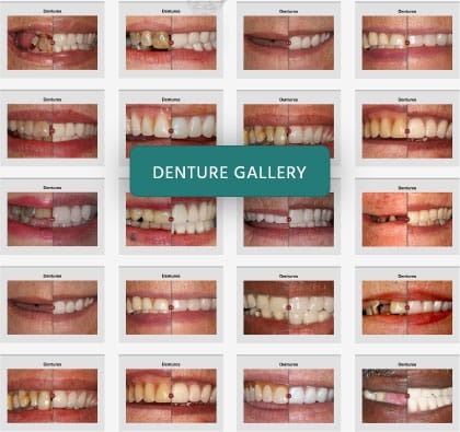 Link to Dr. Azari's Denture Gallery